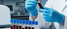 врач-лаборант изучает пробирку с кровью